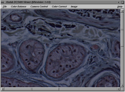 Blood Cells