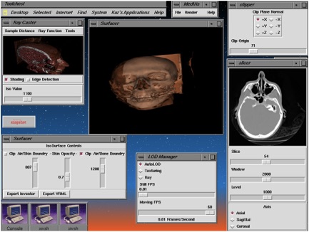 Medical Data Visualizer